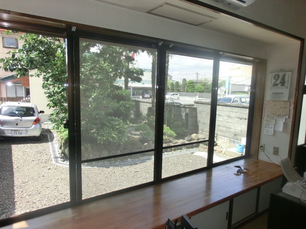 完全硬化までには3週間ほどかかりますが、傷に気をつければ日常生活には問題ありません。